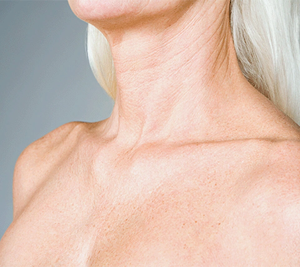 close-up of woman's shoulders and upper chest