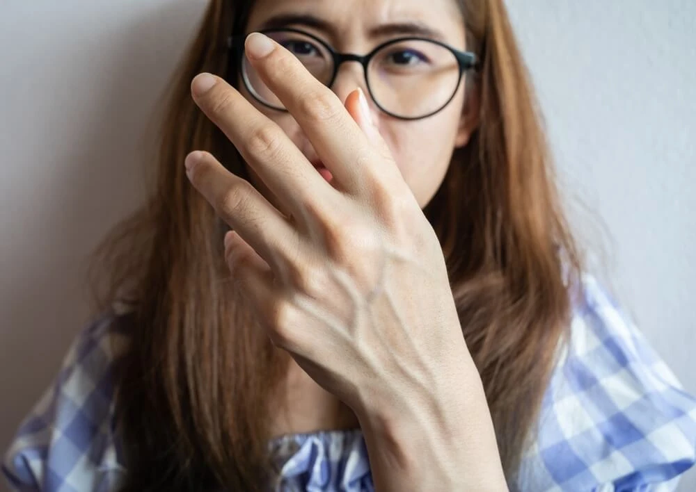 A woman holding up her hand with visible bulging veins