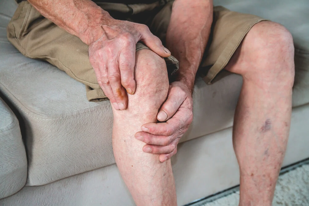 Visible veins across the front of the kneecap can be painful and may need treatment.