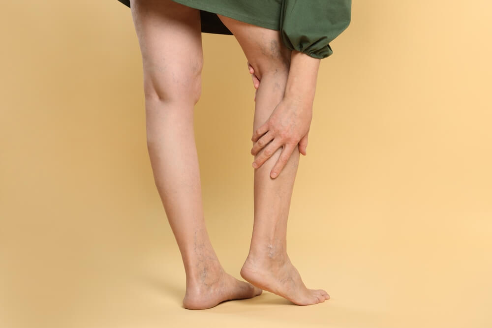Throbbing or aching legs are common varicose vein symptoms
