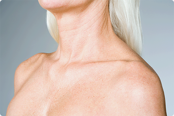 close-up of woman's shoulders and upper chest