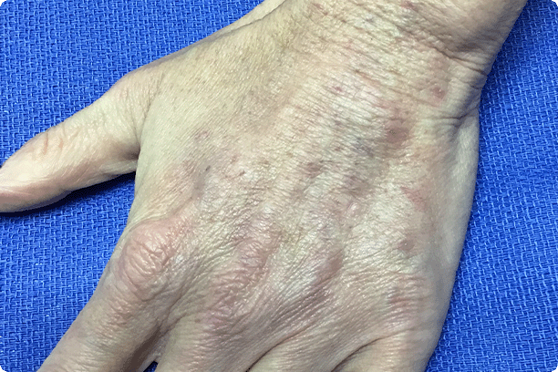 top of hand that does not have visible veins